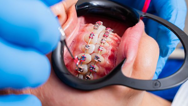 Les meilleures astuces pour sélectionner un orthodontiste à Caen